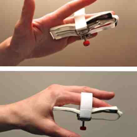 Joint Jack Splint  X-Large